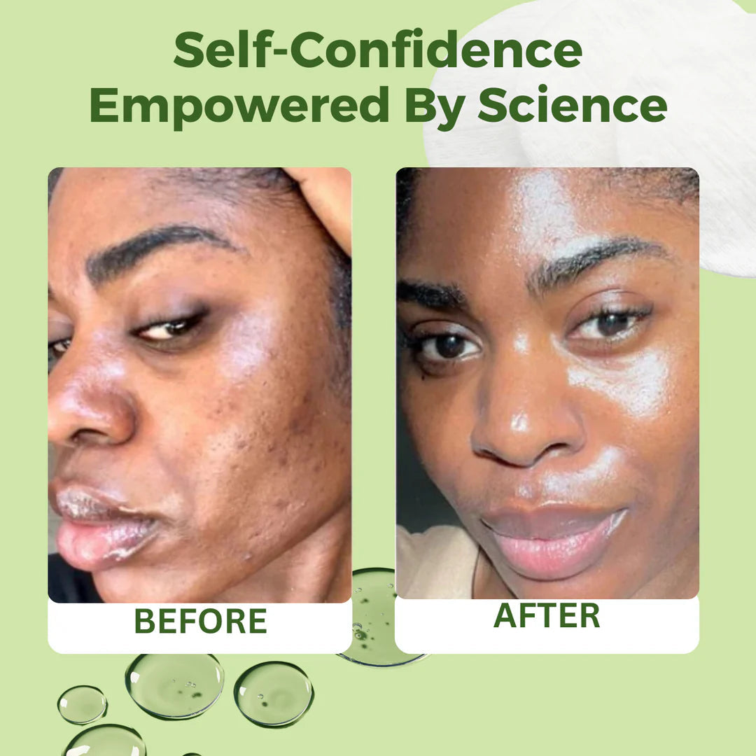 JIYU Skincare Anti-Aging Toner Pads with Snail Mucin, Centella Asiatica, Niacinamide, Peptide Complex - 100 ct.